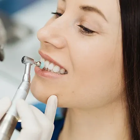 A woman's teeth being polished at the dentist's office